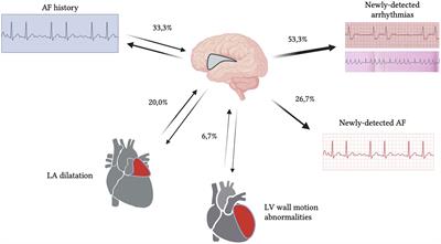 Isolated insular stroke: topography is the answer with respect to outcome and cardiac involvement